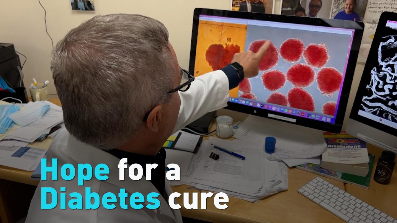 New technique shows promise in the search for a Type 1 Diabetes cure - CGTN