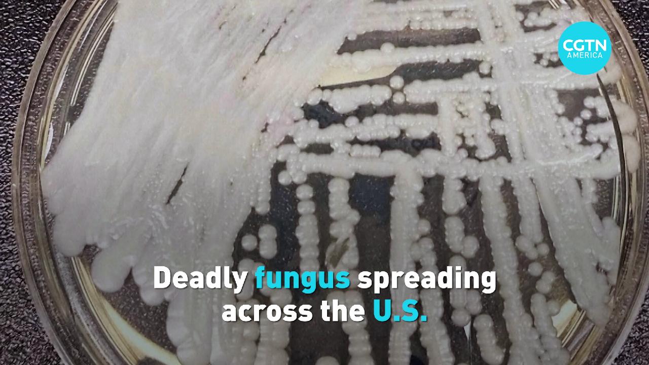 Deadly fungus spreading across the U.S. CGTN