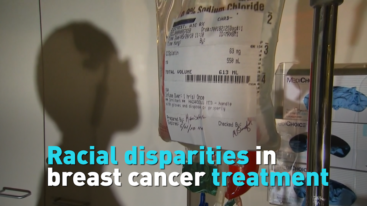 Racial Disparities In Breast Cancer Treatment Cgtn 